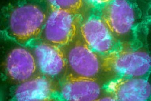 Un espray para visualizar el cáncer en minutos