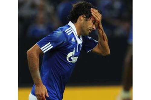 Cae la Roma y el Schalke pasa con goleada