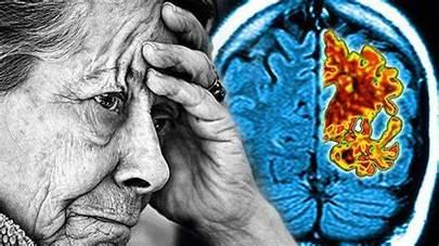 El ayuntamiento de Sanse ayudará a La Asociación de Familiares Afectados de Alzheimer de la ciudad