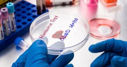 Hantavirus: el virus mortal que enciende las alarmas sanitarias