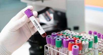 ``Elaboramos un estudio sobre los pacientes COVID-19 atendidos en los centros de salud´´